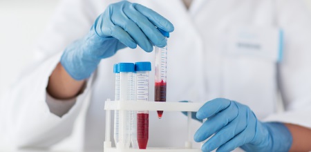 "Researcher Researcher holding a vial of blood.